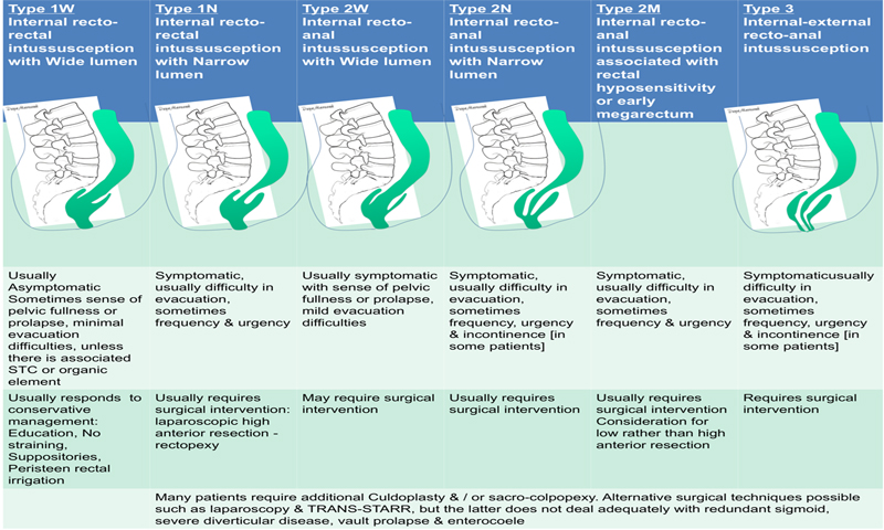 Marzouk IRI classification